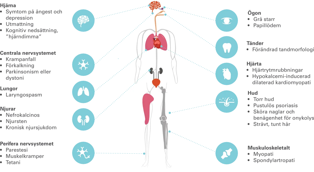 Symtomdiagram