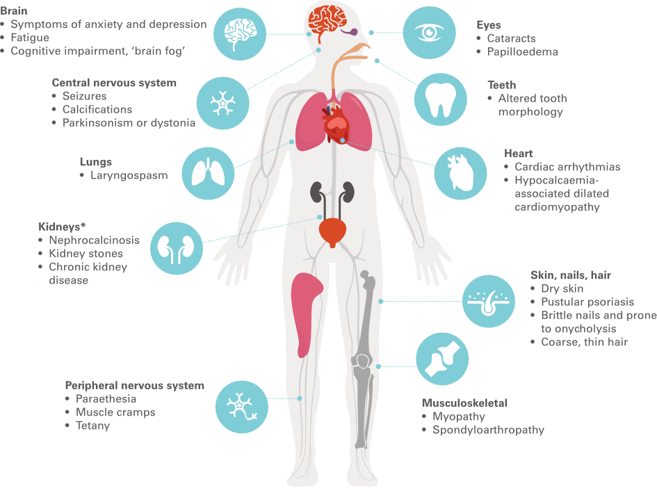 Recognising symptoms graphic