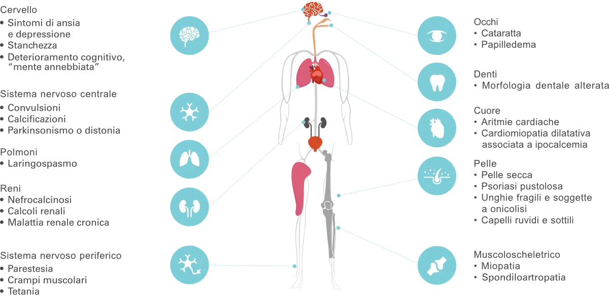 Diagramma dei sintomi