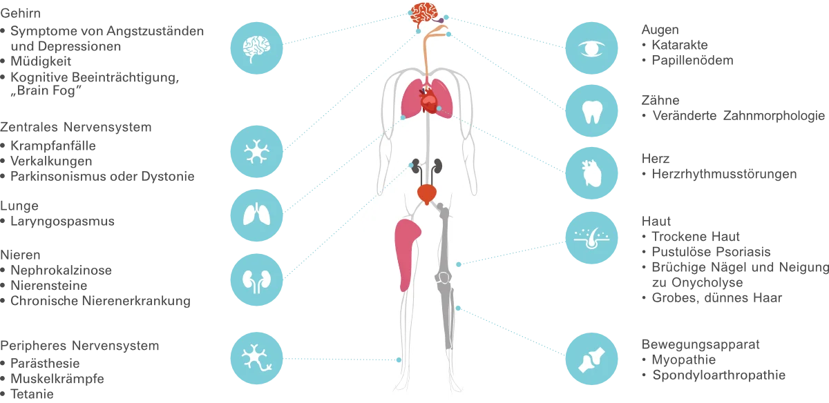 Symptomdiagramm