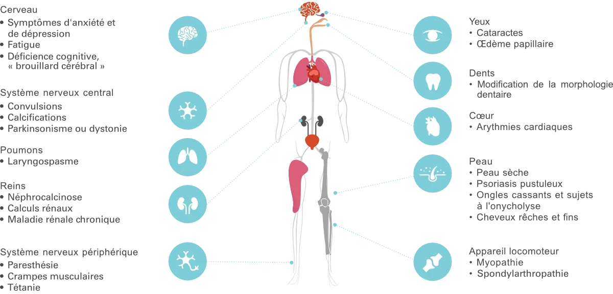 Diagramme des symptômes